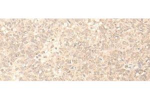Immunohistochemistry (Paraffin-embedded Sections) (IHC (p)) image for anti-Pleckstrin Homology Domain Containing, Family A (phosphoinositide Binding Specific) Member 1 (PLEKHA1) antibody (ABIN7252576)