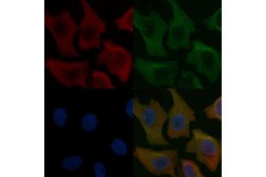 GUCA1A Mouse Monoclonal Antibody staining Hela cells by IF/ICC. (GCAP1 Antikörper)