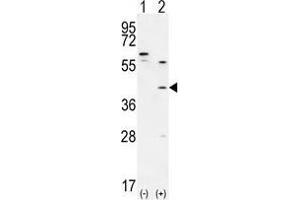 Western blot analysis of TGIF1 (arrow) using rabbit polyclonal TGIF1 Antibody (Center A160) . (TGIF1 Antikörper  (Middle Region))