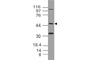 Image no. 1 for anti-Thioredoxin Interacting Protein (TXNIP) (AA 50-300) antibody (ABIN5027615) (TXNIP Antikörper  (AA 50-300))