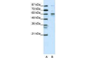 WB Suggested Anti-GTF2F1 Antibody Titration:  0. (GTF2F1 Antikörper  (N-Term))