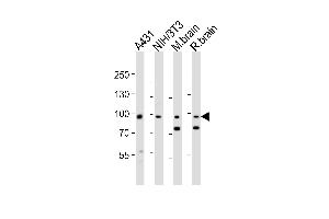 Western blot analysis of lysates from A431, mouse NIH/3T3 cell line, mouse brain, rat brain tissue lysate(from left to right), using Ephb1 Antibody (Center) (ABIN6243653 and ABIN6577762). (EPH Receptor B1 Antikörper  (AA 374-409))