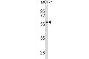 Western Blotting (WB) image for anti-Gc antibody (ABIN2930430) (Gc Antikörper)