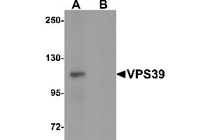 Western Blotting (WB) image for anti-Vacuolar Protein Sorting 39 Homolog (VPS39) (C-Term) antibody (ABIN1030796) (VPS39 Antikörper  (C-Term))