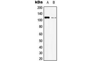 Western blot analysis of BMPR2 expression in HEK293T (A), Raw264. (BMPR2 Antikörper  (N-Term))