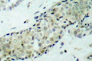 Image no. 1 for anti-Histone Deacetylase 5 (HDAC5) antibody (ABIN265457) (HDAC5 Antikörper)
