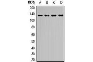 Western blot analysis of EGF expression in K562 (A), Hela (B), HEK293T (C), NIH3T3 (D) whole cell lysates. (EGF Antikörper)