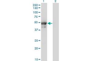 Western Blot analysis of KRT8 expression in transfected 293T cell line by KRT8 monoclonal antibody (M02), clone 3E3. (KRT8 Antikörper  (AA 91-195))