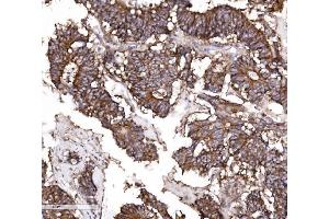 IHC analysis of Claudin 3/CLDN3 using anti-Claudin 3/CLDN3 antibody (ABIN7599626). (Claudin 3 Antikörper  (AA 101-220))