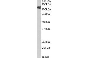 ABIN4902556 (1µg/ml) staining of Human Liver lysate (35µg protein in RIPA buffer). (BMPR2 Antikörper)