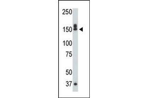 The DK1 polyclonal antibody 7217b is used in Western blot to detect DK1 in mouse liver tissue lysate. (DAP Kinase 1 Antikörper  (C-Term))