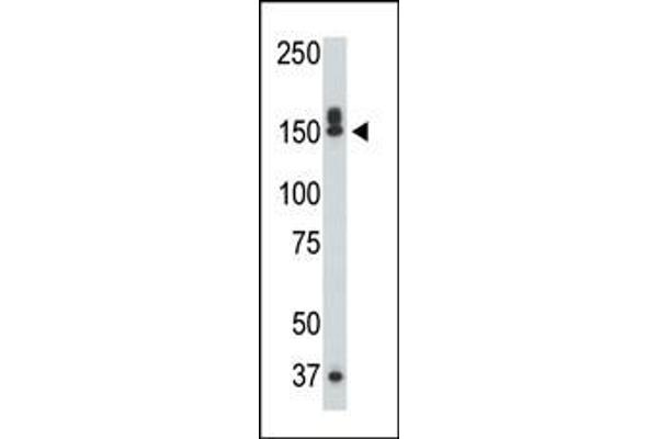 DAP Kinase 1 Antikörper  (C-Term)