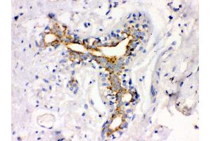 Immunohistochemistry (IHC) image for anti-Ataxin 2 (ATXN2) (AA 1283-1313), (C-Term) antibody (ABIN3043507)