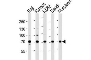 Western blot analysis of lysate from Raji, Ramos, K562, Daudi cell line and mouse spleen tissue lysate using BTK antibody at 1:1000. (BTK Antikörper  (AA 396-430))