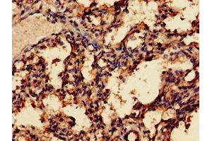 Immunohistochemistry of paraffin-embedded human lung tissue using ABIN7159273 at dilution of 1:100 (MAGEA8 Antikörper  (AA 1-270))
