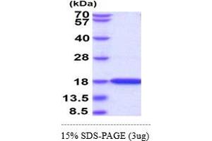 SDS-PAGE (SDS) image for Microtubule-Associated Protein 1 Light Chain 3 alpha (MAP1LC3A) (AA 1-120) protein (His tag) (ABIN667806) (MAP1LC3A Protein (AA 1-120) (His tag))