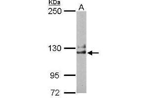 WB Image Sample (50 ug of whole cell lysate) A: Mouse brain 5% SDS PAGE antibody diluted at 1:1000 (NCKAP1 Antikörper)