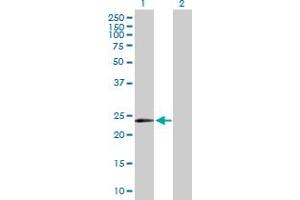 Western Blot analysis of MYCL1 expression in transfected 293T cell line by MYCL1 MaxPab polyclonal antibody. (LMYC Antikörper  (AA 1-206))
