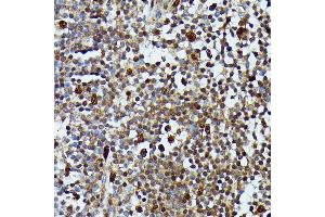 Immunohistochemistry (IHC) image for anti-Mitogen-Activated Protein Kinase Kinase Kinase 3 (MAP3K3) (AA 1-220) antibody (ABIN7268652)