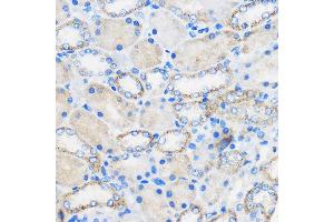 Immunohistochemistry (IHC) image for anti-Retinoic Acid Receptor Responder (Tazarotene Induced) 2 (RARRES2) (AA 17-163) antibody (ABIN6146704)