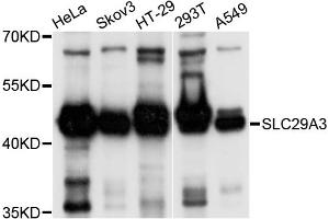 Western blot analysis of extracts of various cell lines, using SLC29A3 antibody (ABIN4905193) at 1:1000 dilution. (SLC29A3 Antikörper)