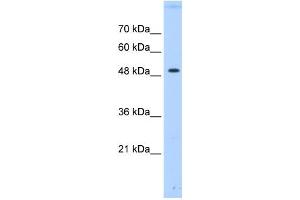 PTPN1 antibody used at 0. (PTPN1 Antikörper  (Middle Region))