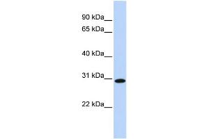 WB Suggested Anti-SMNDC1 Antibody Titration:  0. (SMNDC1 Antikörper  (Middle Region))