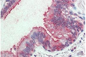 Anti-SLC44A2 antibody  ABIN1049339 IHC staining of human lung, respiratory epithelium. (SLC44A2 Antikörper  (Internal Region))