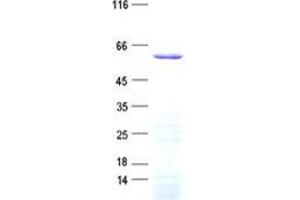 Validation with Western Blot (DYTN Protein (His tag))