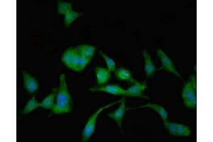 Immunofluorescent analysis of Hela cells using ABIN7143903 at dilution of 1:100 and Alexa Fluor 488-congugated AffiniPure Goat Anti-Rabbit IgG(H+L) (MAN2C1 Antikörper  (AA 746-969))