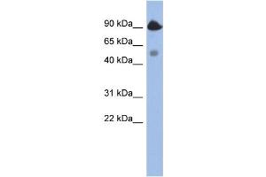 WB Suggested Anti-BCL2L13 Antibody Titration:  0. (BCL2L13 Antikörper  (Middle Region))