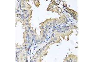 Immunohistochemistry of paraffin-embedded human prostate using CXCR4 antibody (ABIN6292854) at dilution of 1:100 (40x lens). (CXCR4 Antikörper)