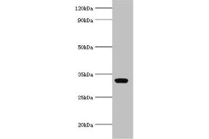 Western blot All lanes: AGPAT1 antibody at 6 μg/mL + K562 whole cell lysate Secondary Goat polyclonal to rabbit IgG at 1/10000 dilution Predicted band size: 32 kDa Observed band size: 32 kDa (AGPAT1 Antikörper  (AA 204-283))