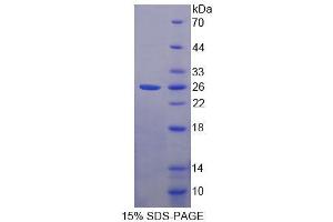 SDS-PAGE (SDS) image for Fast Skeletal Troponin I (TNNI2) (AA 1-182) protein (His tag) (ABIN1081041)