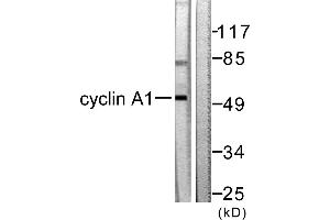 Western blot analysis of extracts from SKOV3 cells, using Cyclin A1 antibody (#C0166). (Cyclin A1 Antikörper)