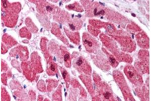 Human Heart (formalin-fixed, paraffin-embedded) stained with MAPK1 antibody ABIN305764 at 5 ug/ml followed by biotinylated anti-mouse IgG secondary antibody ABIN481714, alkaline phosphatase-streptavidin and chromogen. (ERK2 Antikörper)