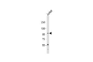 Anti-LARGE Antibody (Center) at 1:2000 dilution + Jurkat whole cell lysate Lysates/proteins at 20 μg per lane.