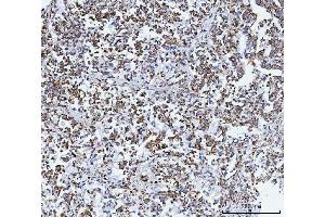 IHC analysis of GLUD1/2 using anti-GLUD1/2 antibody (ABIN7602000). (GLUD1 / GLUD2 (AA 54-553) Antikörper)