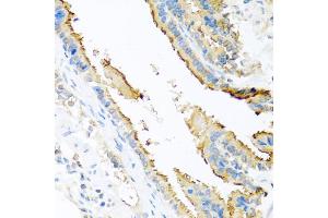 Immunohistochemistry of paraffin-embedded mouse lung using ApoE antibody (ABIN5975768) at dilution of 1/100 (40x lens). (APOE Antikörper)
