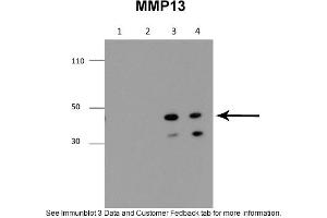 Sample Type: 1. (MMP13 Antikörper  (Middle Region))