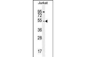 Western blot analysis in Jurkat cell line lysates (35ug/lane). (DARS Antikörper  (N-Term))
