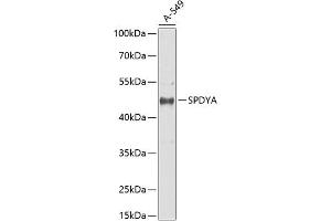 Western blot analysis of extracts of  cells, using SPDYA antibody (ABIN6132705, ABIN6148336, ABIN6148337 and ABIN6217670) at 1:1000 dilution.