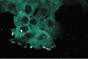 Immunofluorescence staining of A431 cells. (KIF11 Antikörper  (AA 324-532))