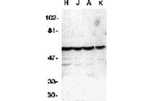 Western Blotting (WB) image for anti-Caspase 10, Apoptosis-Related Cysteine Peptidase (CASP10) (C-Term) antibody (ABIN1030316) (Caspase 10 Antikörper  (C-Term))