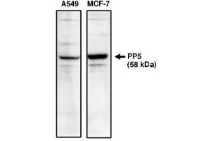 Image no. 1 for anti-Protein Phosphatase 5, Catalytic Subunit (PPP5C) antibody (ABIN265046) (PP5 Antikörper)