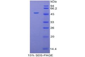 SDS-PAGE analysis of Cow Orosomucoid 1 Protein. (ORM1 Protein)