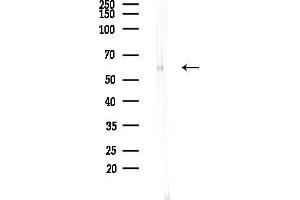 Western blot analysis of lysates from Mouse brain, using Phospho-Fyn (Tyr530)[Tyr531] Antibody at 1/1000 dilution.