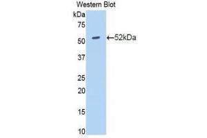 Western Blotting (WB) image for anti-Amyloid P Component, Serum (APCS) (AA 23-223) antibody (ABIN1860495)