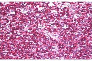 Immunohistochemistry staining of human tonsil (paraffin sections) using anti-CD45RB (clone MEM-143). (CD45RB Antikörper)