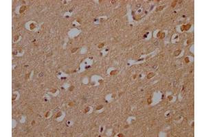 IHC image of ABIN7139953 diluted at 1:200 and staining in paraffin-embedded human brain tissue performed on a Leica BondTM system. (OR1A2 Antikörper  (AA 247-262))